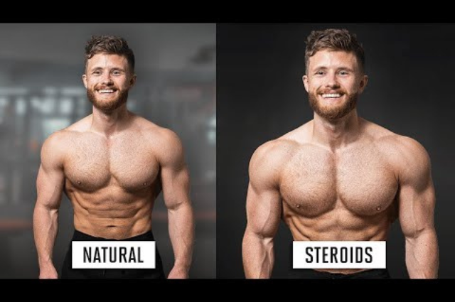 Long Term Effects of Anabolic Steroids